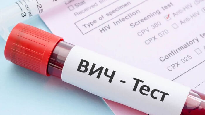Rusya’da yabancılardan HIV testi vermeleri istenebilir
