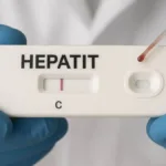 Rospotrebnadzor, Çekya’dan Gelenlere Hepatit Testi Yapıldığı İddialarını Yalanladı